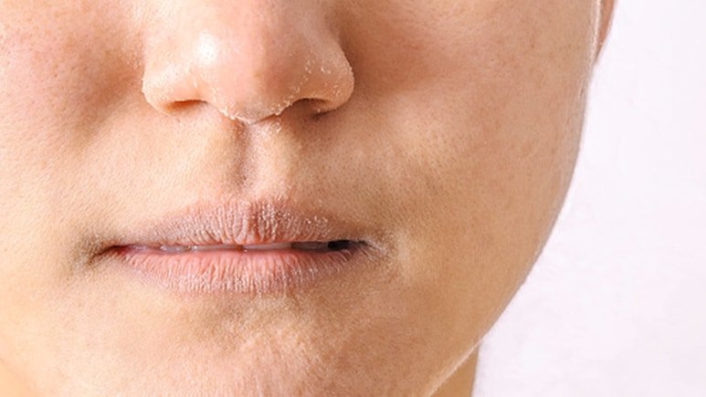 ठंडियों में ये 9 घरेलू उपाय आपकी स्किन का रखेंगे ध्यान, बनी रहेगी चेहरे की नमी नहीं पड़ेगी त्वचा रूखी