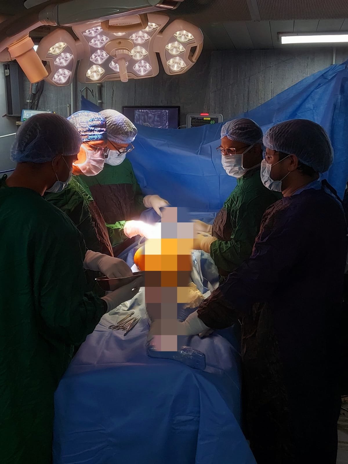 अम्बेडकर अस्पताल में टोटल हिप रिप्लेसमेंट एवं टोटल नी रिप्लेसमेंट की सुविधा उपलब्ध