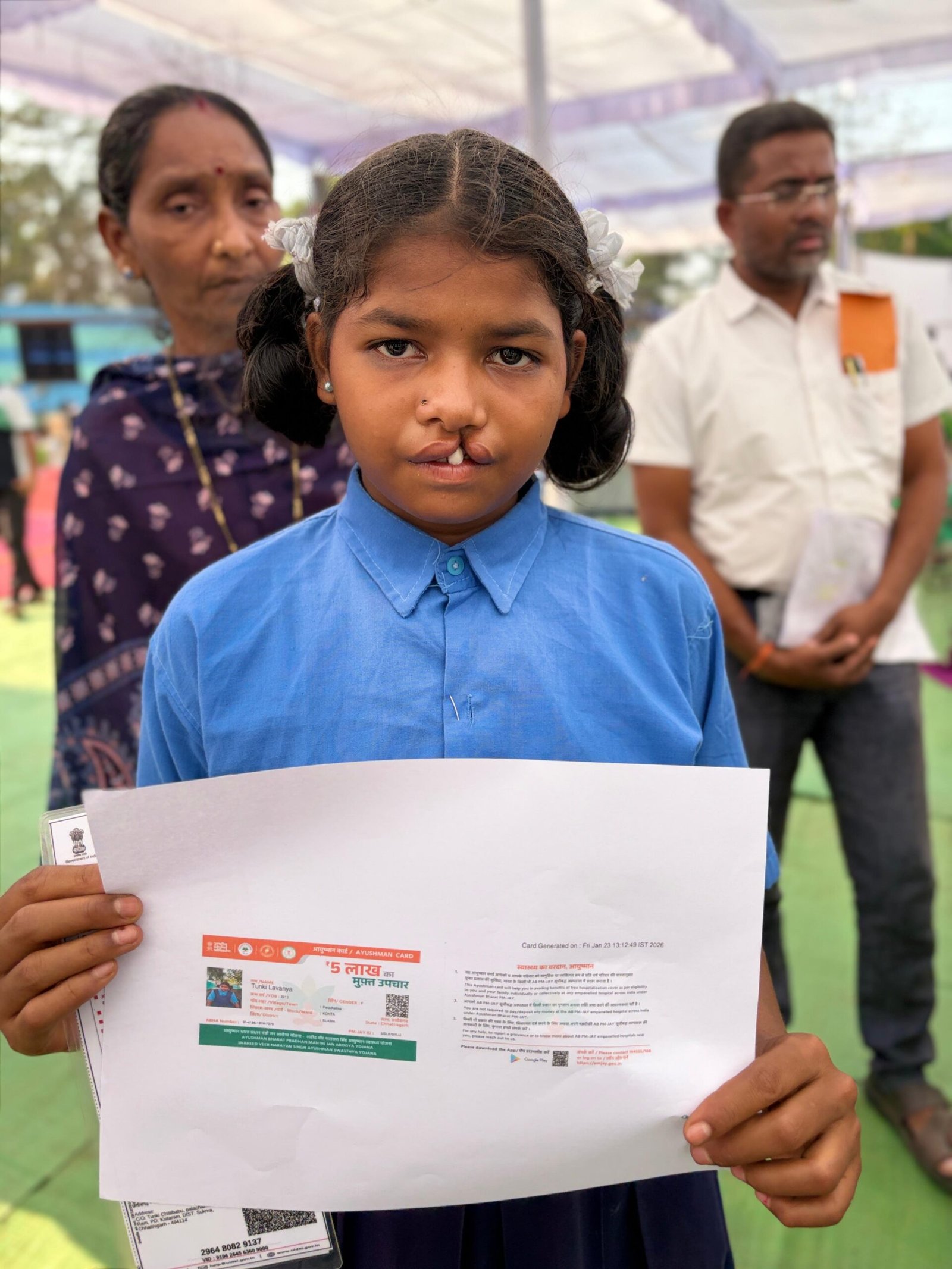 कटे होंठ से टूटी हिम्मत तक… एक ऑपरेशन और बदल गई जिंदगी