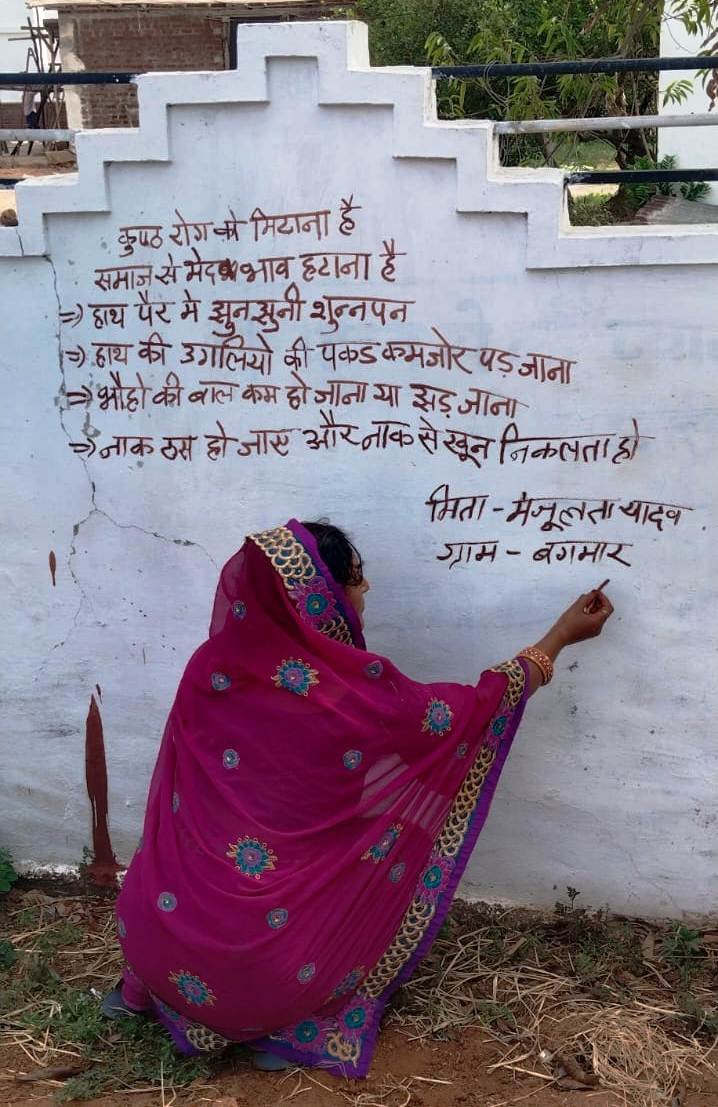 राष्ट्रीय कुष्ठ उन्मूलन कार्यक्रम के तहत सघन कुष्ठ खोज अभियान 15 जून से 15 जुलाई तक