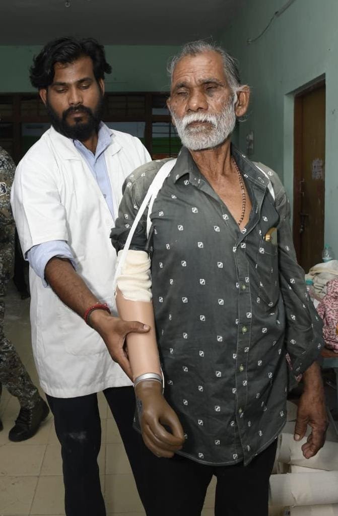 ट्रेन हादसे के दर्द पर ‘सेवा संकल्प’ का मरहम, धमतरी के तेजराम को दो घंटे में मिला कृत्रिम हाथ, लौटी जिंदगी की रंगत